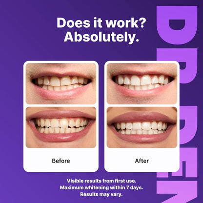 Purple Teeth Whitening Strips 21 Treatments - Safe for Enamel - Non Sensitive Teeth Whitening - Whitening Without Any Harm - Pack of 42.